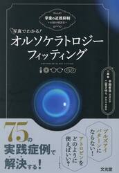 写真でわかる！オルソケラトロジーフィッティング　学童の近視抑制　お悩み相談室