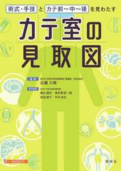 カテ室の見取図　術式・手技とカテ前〜中〜後を見わたす