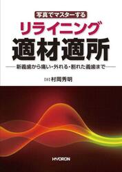 写真でマスターするリライニング適材適所　新義歯から痛い・外れる・割れた義歯まで
