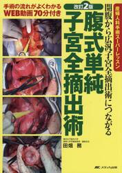 腹式単純子宮全摘出術　開腹から広汎子宮全摘出術につながる