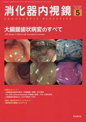 消化器内視鏡　Ｖｏｌ．３４Ｎｏ．５（２０２２Ｍａｙ）