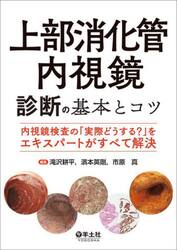 上部消化管内視鏡診断の基本とコツ　内視鏡検査の「実際どうする？」をエキスパートがすべて解決
