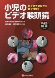 小児のビデオ喉頭鏡　ビデオで見ながら楽々挿管！