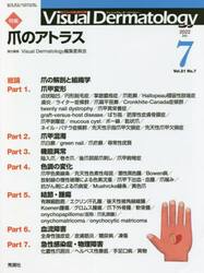 Ｖｉｓｕａｌ　Ｄｅｒｍａｔｏｌｏｇｙ　目でみる皮膚科学　Ｖｏｌ．２１Ｎｏ．７（２０２２−７）