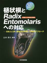 樋状根とＲａｄｉｘ　Ｅｎｔｏｍｏｌａｒｉｓへの対応　日本人に多い解剖学的形態への臨床アプローチ