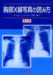 胸部Ｘ線写真の読み方/中外医学社/大場覚（ペーパーバック） 中外医学社 | 書籍詳細