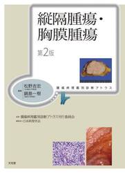 縦隔腫瘍・胸膜腫瘍