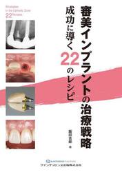 審美インプラントの治療戦略　成功に導く２２のレシピ