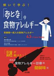 解いて学ぶ！「おとな」の食物アレルギー　思春期〜成人の食物アレルギー４３のＣａｓｅ　Ｓｔｕｄｙ