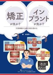 矯正が先か？インプラントが先か？　欠損補綴の治療計画を極める