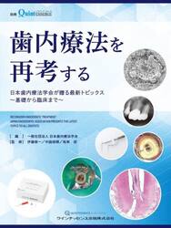 歯内療法を再考する　日本歯内療法学会が贈る最新トピックス〜基礎から臨床まで〜