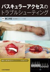 バスキュラーアクセスのトラブルシューティング