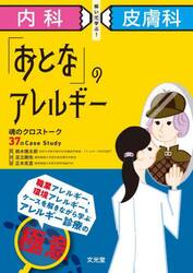 内科×皮膚科解いて学ぶ！「おとな」のアレルギー　魂のクロストーク３７のＣａｓｅ　Ｓｔｕｄｙ