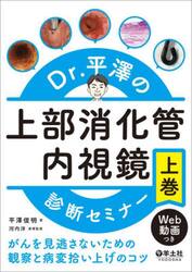 Ｄｒ．平澤の上部消化管内視鏡診断セミナー　がんを見逃さないための観察と病変拾い上げのコツ　上巻