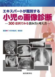エキスパートが鑑別する小児の画像診断　３００症例でみる読み方と考え方