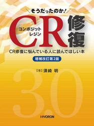 そうだったのか！ＣＲ（コンポジットレジン）修復　ＣＲ修復に悩んでいる人に読んでほしい本