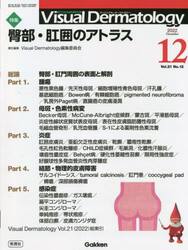 Ｖｉｓｕａｌ　Ｄｅｒｍａｔｏｌｏｇｙ　目でみる皮膚科学　Ｖｏｌ．２１Ｎｏ．１２（２０２２−１２）