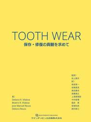 ＴＯＯＴＨ　ＷＥＡＲ　保存・修復の真髄を求めて