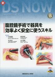 腹腔鏡手術で器具を効率よく安全に使うスキル
