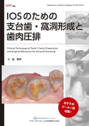 ＩＯＳのための支台歯・窩洞形成と歯肉圧排