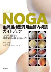 ＮＯＧＡ血流維持型汎用血管内視鏡ガイドブック　あらゆる臓器の動脈硬化の概念が変わる！