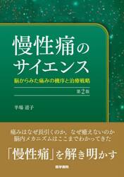 慢性痛のサイエンス　脳からみた痛みの機序と治療戦略