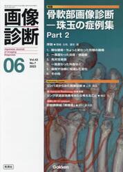 画像診断　Ｖｏｌ．４３Ｎｏ．７（２０２３−０６）