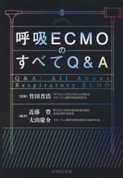 呼吸ＥＣＭＯのすべてＱ＆Ａ