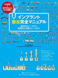 インプラント撤去完全マニュアル　基本的なケースから，骨削除が必要なケースまで
