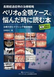 長期経過症例の治療戦略ペリオ＆全顎ケースに悩んだ時に読む本　治療方針とテクニック徹底解説