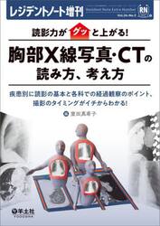 読影力がグッと上がる！胸部Ｘ線写真・ＣＴの読み方、考え方　疾患別に読影の基本と各科での経過観察のポイント、撮影のタイミングがイチからわかる！