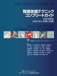智歯抜歯テクニックコンプリートガイド　はまる原因，はまらない対策と処置