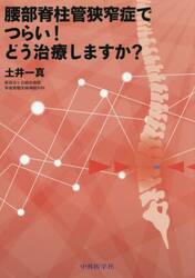 腰部脊柱管狭窄症でつらい！どう治療します