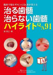 治る歯髄治らない歯髄ハイライトＱ＆Ａ９１　臨床で悩むギモンにＤｒ．泉が答える