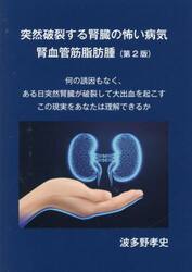 突然破裂する腎臓の怖い病気腎血管筋脂肪腫　何の誘因もなく、ある日突然腎臓が破裂して大出血を起こすこの現実をあなたは理解できるか
