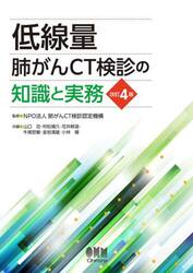 低線量肺がんＣＴ検診の知識と実務