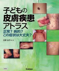 子どもの皮膚疾患アトラス　正常？病的？この症状は大丈夫？