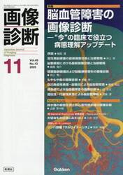 画像診断　Ｖｏｌ．４５Ｎｏ．１３（２０２５年１１月号）